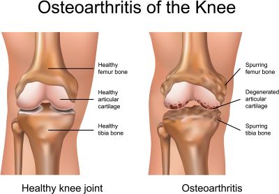 NRS Sports Therapy Provide Feedback on Effective Use of the Mag-Expert